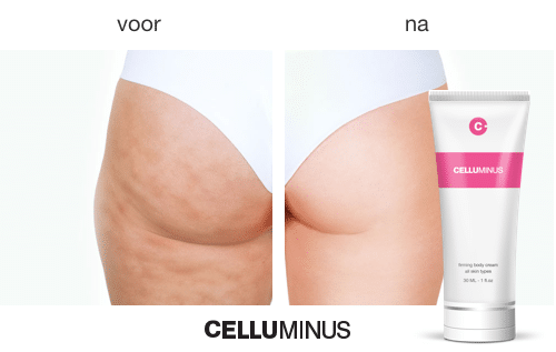 Sinaasappelhuid en Cellulitis verwijderen | Celluminus helpt